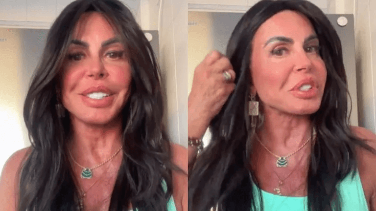 Gretchen exibe novo rosto e explica: “não existe desarmonização”