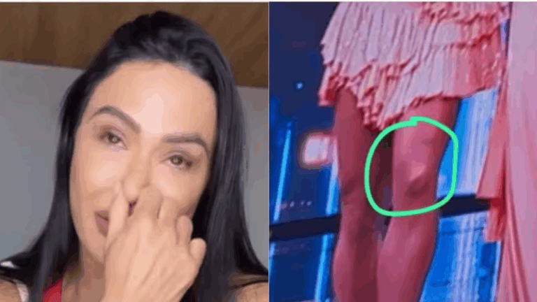 Gracyanne Barbosa chora ao reviver o momento da lesão no joelho.