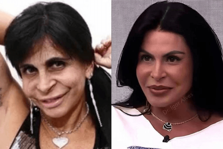 Gretchen faz mudança drástica no visual e é comparada a Ana Castela.