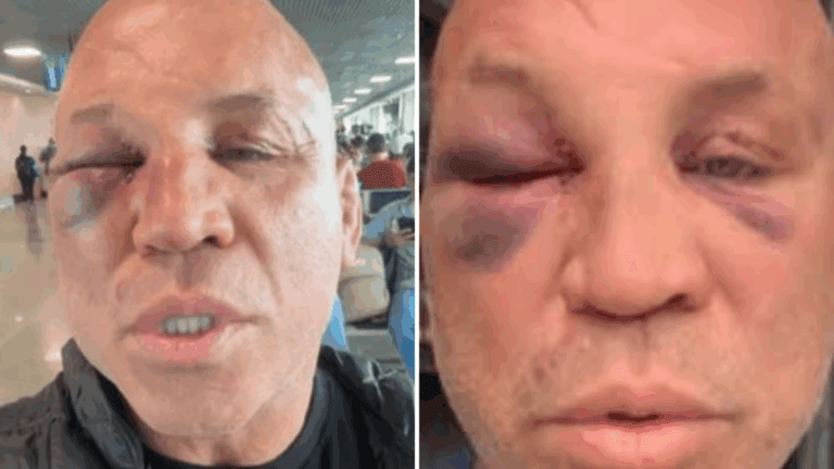 Wanderlei Silva vai à justiça após sofrer agressões em confusão