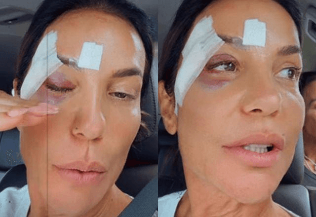 Ivete Sangalo recebe alta após desmaio e acidente doméstico: “Já estou bem”