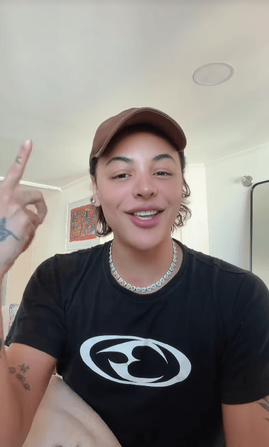 Pabllo Vittar exibe resultado da terceira rinoplastia e relata contratempo na recuperação
