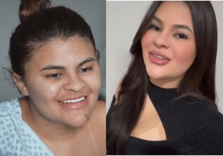 Equipe de hospital público reimplanta mãos de estudante vítima de tentativa de feminicídio no Ceará