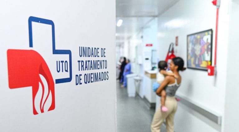 HUSE reforça alertas contra queimaduras nos festejos juninos