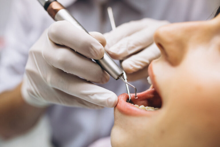 USP lança IA que identifica dentes e detecta cáries em radiografias